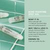 imageelf SKIN Blemish Breakthrough Acne Fighting Spot Gel Rollon For Treating Blemishes Made With Salicylic Acid Vegan ampamp CrueltyFree