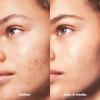 imageelf SKIN Blemish Breakthrough Calming Water Cream Lightweight BlemishFighting Face Moisturiser Prevents New Blemishes ampamp Calms Skin1 Fl Oz Pack of 1