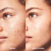 imageelf SKIN Blemish Breakthrough Clarifying Cleanser Gel Cleanser For Removing Makeup Controlling Oil ampamp Clarifying Pores 1 Salicylic Acid388 Fl Oz Pack of 1