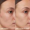imageelf SKIN PLZ Clarify Facial Oil Face Oil For Treating ampamp Preventing Acne Helps Calm Redness Made with Salicylic Acid Vegan ampamp CrueltyFree 1 oz