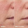 imageelf SKIN Youth Boosting Bluety Sleep Night Oil Gentle Overnight Face Oil Treats Fine Lines ampamp Uneven Texture Lightweight Vegan ampamp CrueltyFree